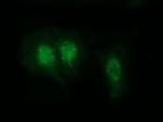 RABL2A Monoclonal Antibody (OTI4A8)