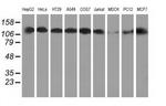 HDAC6 Antibody in Western Blot (WB)