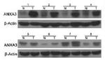 Annexin A3 Antibody in Western Blot (WB)