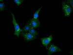 CLPP Monoclonal Antibody (OTI1D8)