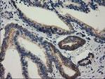 RASD2 Antibody in Immunohistochemistry (Paraffin) (IHC (P))