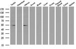 LMAN1 Antibody in Western Blot (WB)