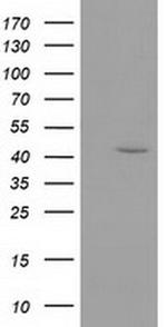 GMDS Monoclonal Antibody (OTI2A1)