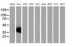 VSIG2 Antibody in Western Blot (WB)
