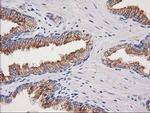 CDCP1 Antibody in Immunohistochemistry (Paraffin) (IHC (P))