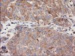 CDCP1 Antibody in Immunohistochemistry (Paraffin) (IHC (P))