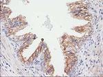 CDCP1 Antibody in Immunohistochemistry (Paraffin) (IHC (P))