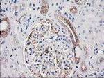 CDCP1 Antibody in Immunohistochemistry (Paraffin) (IHC (P))