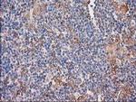 CDCP1 Antibody in Immunohistochemistry (Paraffin) (IHC (P))