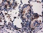 FAM127C Antibody in Immunohistochemistry (Paraffin) (IHC (P))