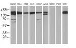 HDAC6 Antibody in Western Blot (WB)
