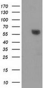 DTNA Antibody in Western Blot (WB)