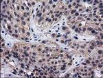 HSP40 Antibody in Immunohistochemistry (Paraffin) (IHC (P))