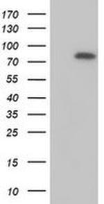 MTMR2 Monoclonal Antibody (OTI5G5)