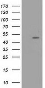 PACSIN3 Antibody in Western Blot (WB)