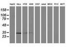 NMNAT1 Antibody in Western Blot (WB)