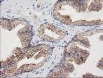 CDCP1 Antibody in Immunohistochemistry (Paraffin) (IHC (P))