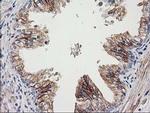 CDCP1 Antibody in Immunohistochemistry (Paraffin) (IHC (P))