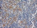 CDCP1 Antibody in Immunohistochemistry (Paraffin) (IHC (P))