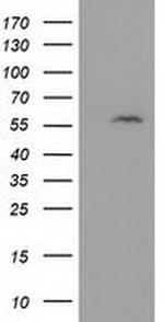 DTNA Antibody in Western Blot (WB)