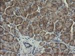 SERPINB3 Antibody in Immunohistochemistry (Paraffin) (IHC (P))