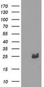 MMAB Antibody in Western Blot (WB)