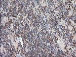 PIP4K2A Antibody in Immunohistochemistry (Paraffin) (IHC (P))