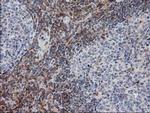 PIP4K2A Antibody in Immunohistochemistry (Paraffin) (IHC (P))