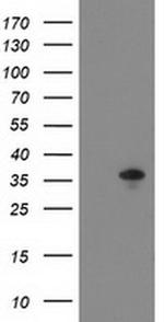 ACY3 Monoclonal Antibody (OTI2G4)