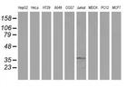 ACY3 Antibody in Western Blot (WB)