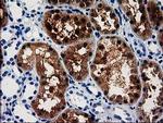 ACY3 Antibody in Immunohistochemistry (Paraffin) (IHC (P))