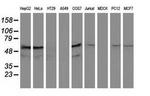 KATNAL1 Antibody in Western Blot (WB)