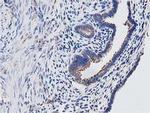 OGFOD1 Antibody in Immunohistochemistry (Paraffin) (IHC (P))