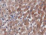 OGFOD1 Antibody in Immunohistochemistry (Paraffin) (IHC (P))