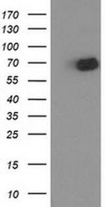 OGFOD1 Antibody in Western Blot (WB)