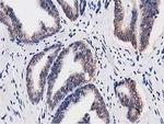 C20orf43 Antibody in Immunohistochemistry (Paraffin) (IHC (P))
