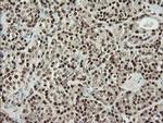 MCTS1 Antibody in Immunohistochemistry (Paraffin) (IHC (P))
