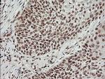 MCTS1 Antibody in Immunohistochemistry (Paraffin) (IHC (P))