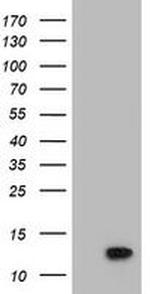 POLR2J2 Antibody in Western Blot (WB)