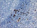 S100A12 Antibody in Immunohistochemistry (Paraffin) (IHC (P))
