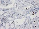 S100A12 Antibody in Immunohistochemistry (Paraffin) (IHC (P))