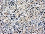 UBA2 Antibody in Immunohistochemistry (Paraffin) (IHC (P))