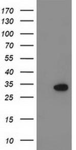 KCTD14 Antibody in Western Blot (WB)