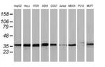 UBXN2B Antibody in Western Blot (WB)