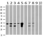 UBXN2B Monoclonal Antibody (OTI3H8)