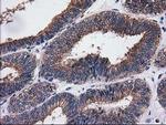 SULT1C2 Antibody in Immunohistochemistry (Paraffin) (IHC (P))