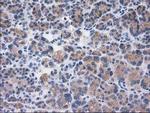 SULT1C2 Antibody in Immunohistochemistry (Paraffin) (IHC (P))