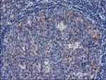 SULT1C2 Antibody in Immunohistochemistry (Paraffin) (IHC (P))