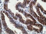 15-PGDH Monoclonal Antibody (OTI2C10)
