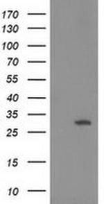15-PGDH Antibody in Western Blot (WB)